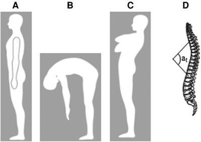 Effects of an 8-week multimodal program on thoracic posture, glenohumeral range of motion and serve performance in competitive young tennis players